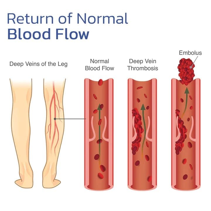Samohrejivá kolenná ortéza: rýchla úľava od bolesti