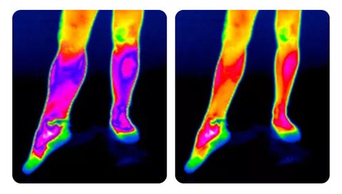Samohrejivá kolenná ortéza: rýchla úľava od bolesti